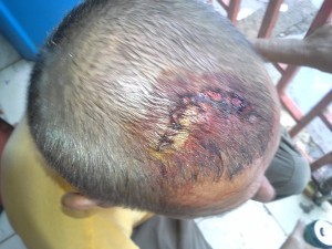 Dembéni : un homme agressé à son domicile