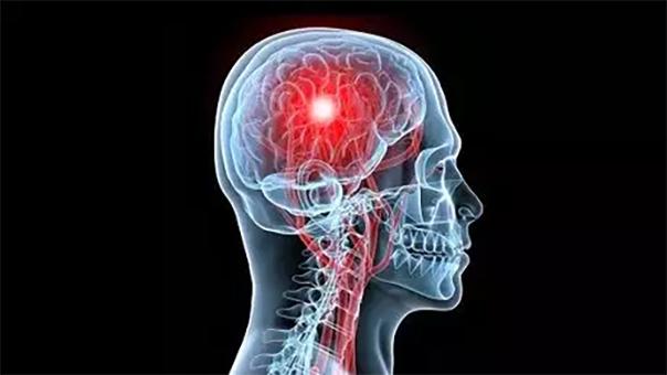 AVC, pas de bol pour Mayotte