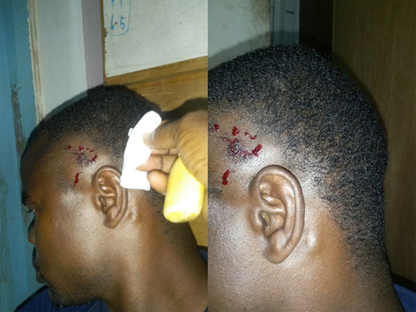 Les photos de l’agression gratuite subie par le policier