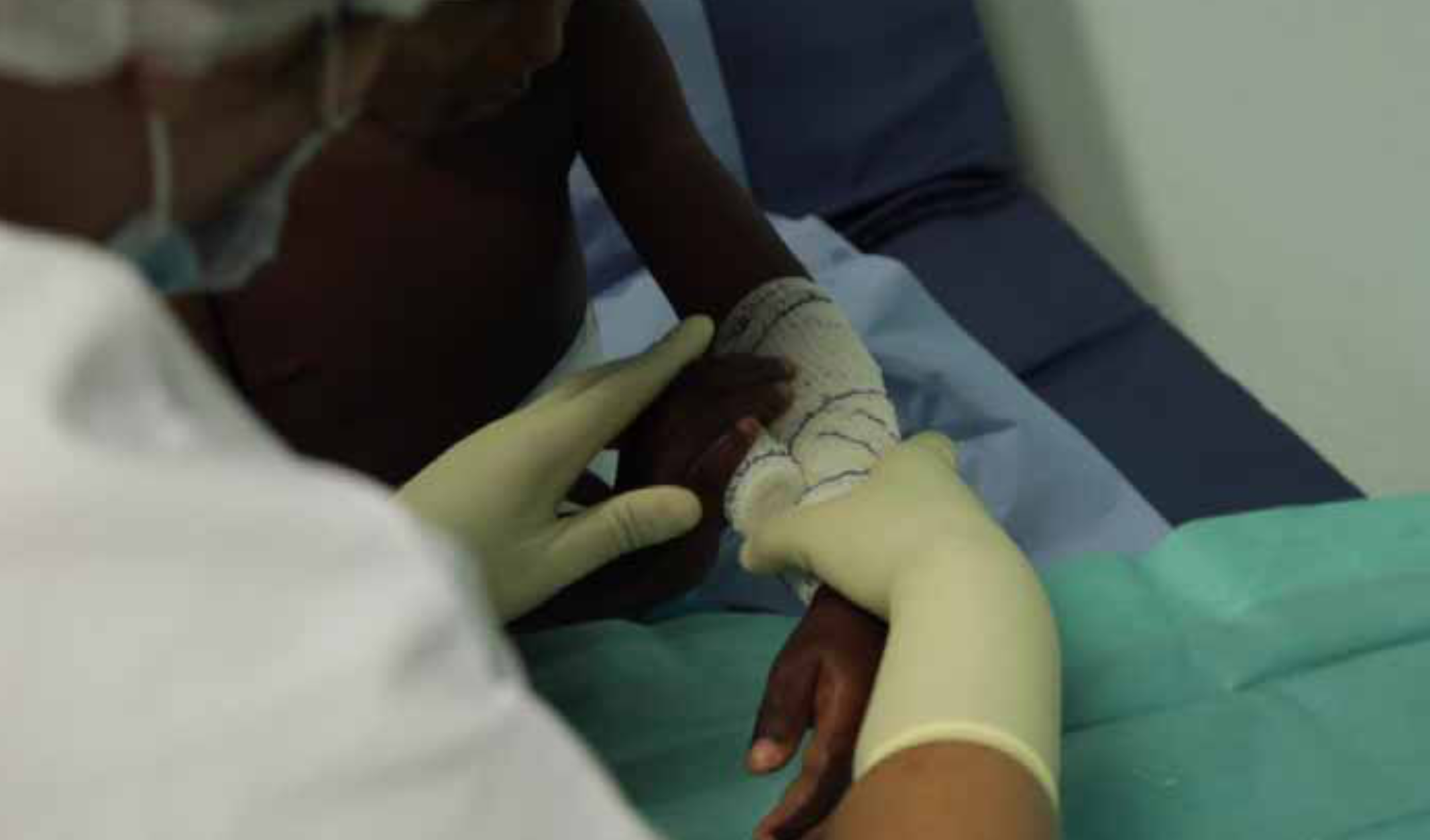 Immersion au sein du service des Grands Brûlés du CHM