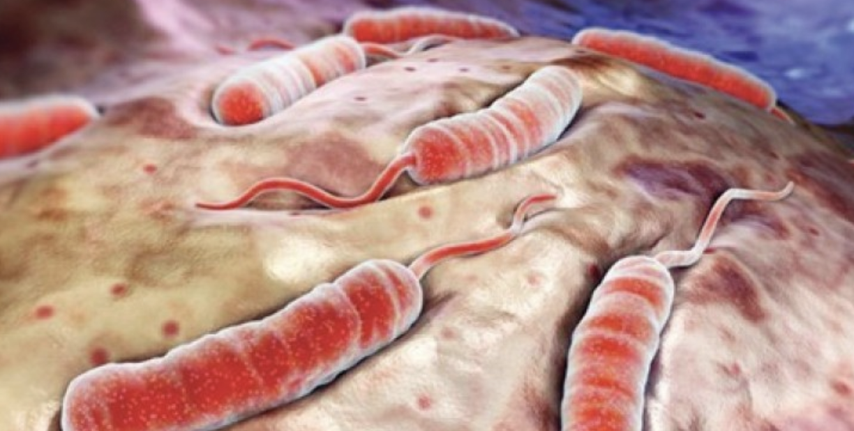 Suspicion de cas de choléra en Union des Comores