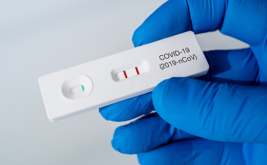 Liste Des Pharmacies de Mayotte réalisant les tests Antigéniques pour voyager