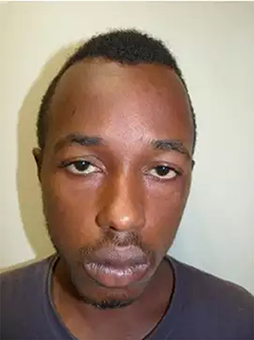 Fin de cavale pour Mdéré