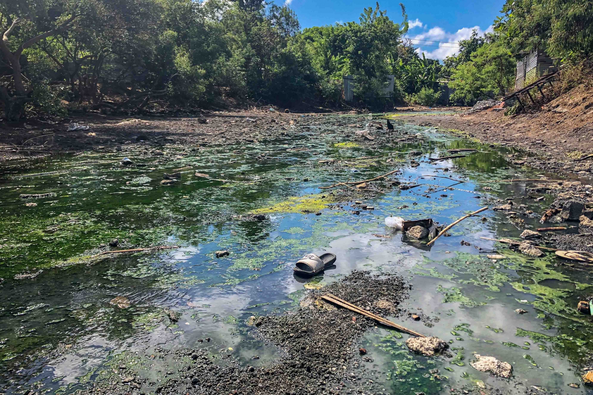 Après la dengue et la Covid il faut désormais se méfier de la typhoïde