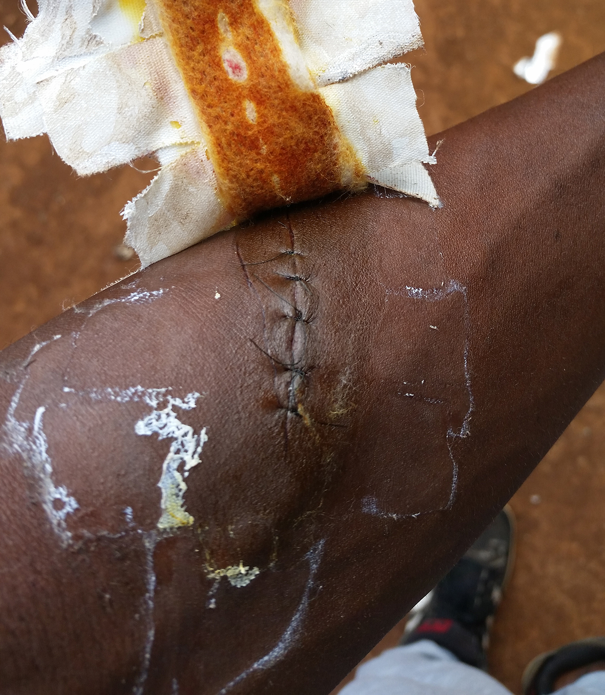 Agression au coup de couteau à Kahani