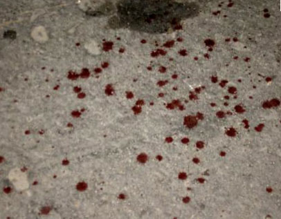 Coup de couteau devant le lycée