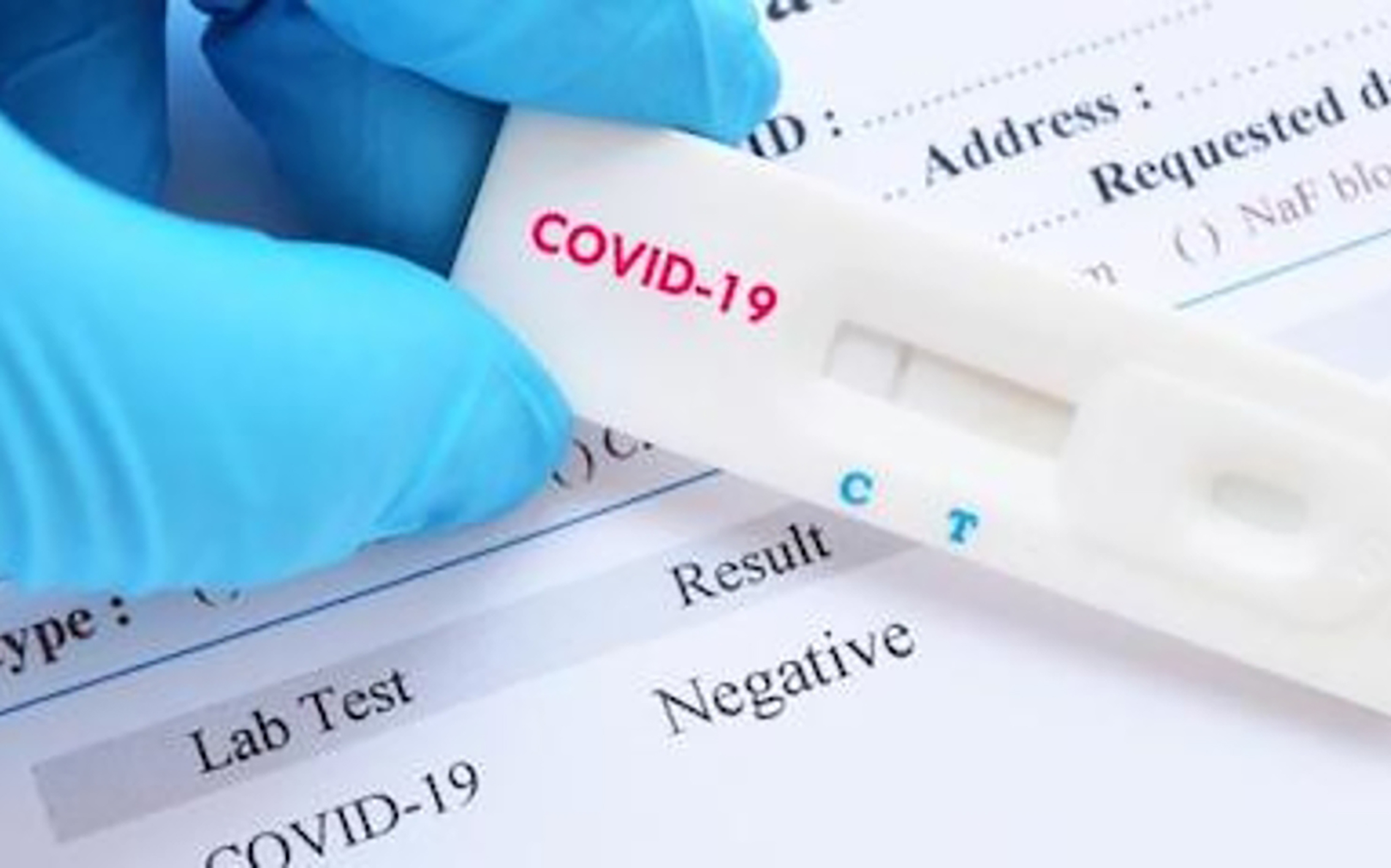 95% des cas positifs de Mayotte le sont à un variant du Covid