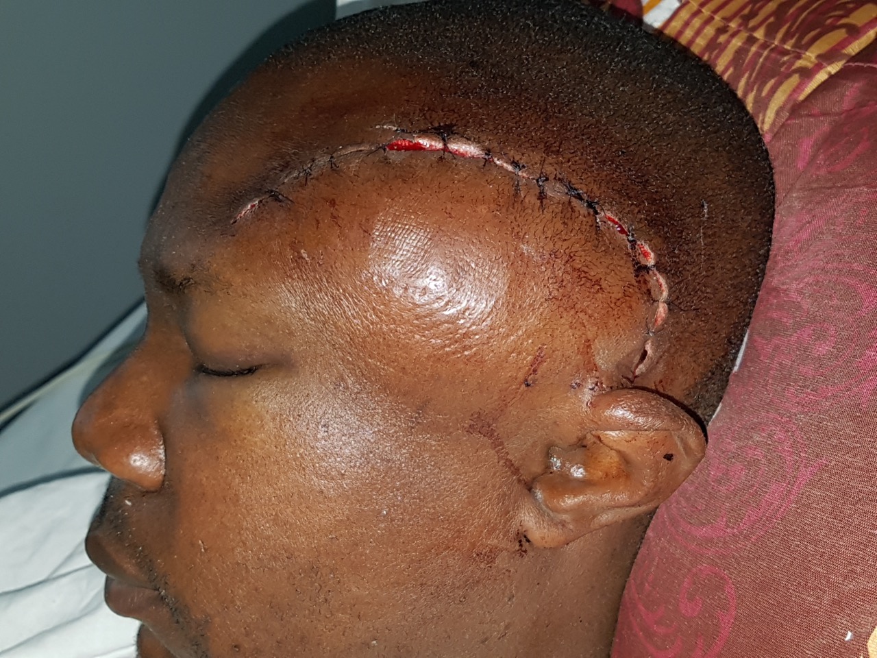 Agressé à la machette, défiguré, il écrit au procureur