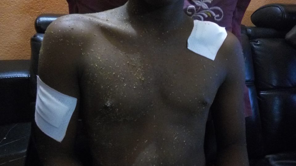 Agression des “supporters sadois” envers les joueurs du RC Barakani après une rencontre sportive