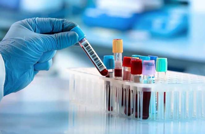 Le Coronavirus ou Covid 19 mobilise la Commission de l’Océan Indien