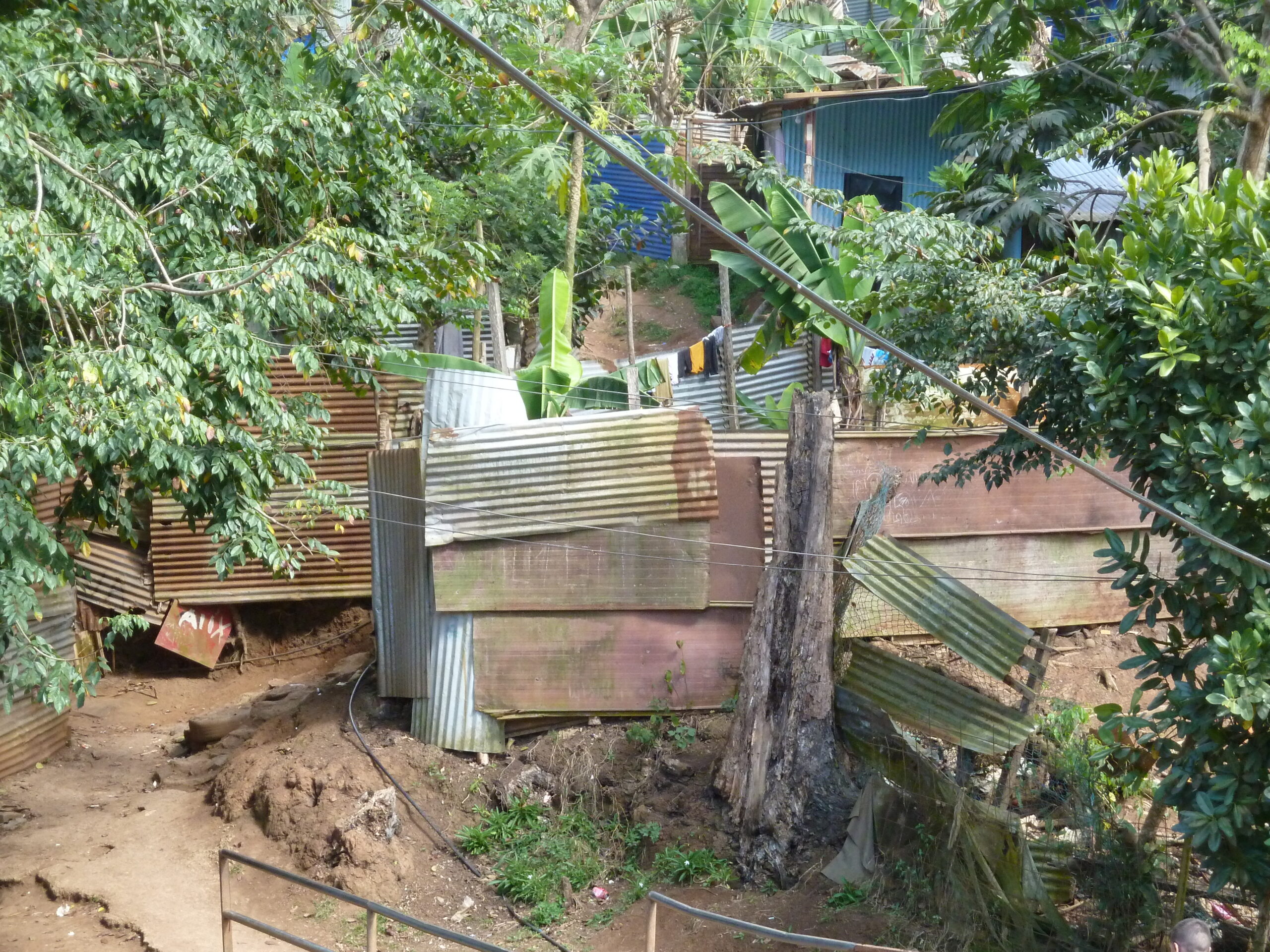 Bidonville de Vahibé : une petite fille entre la vie et la mort