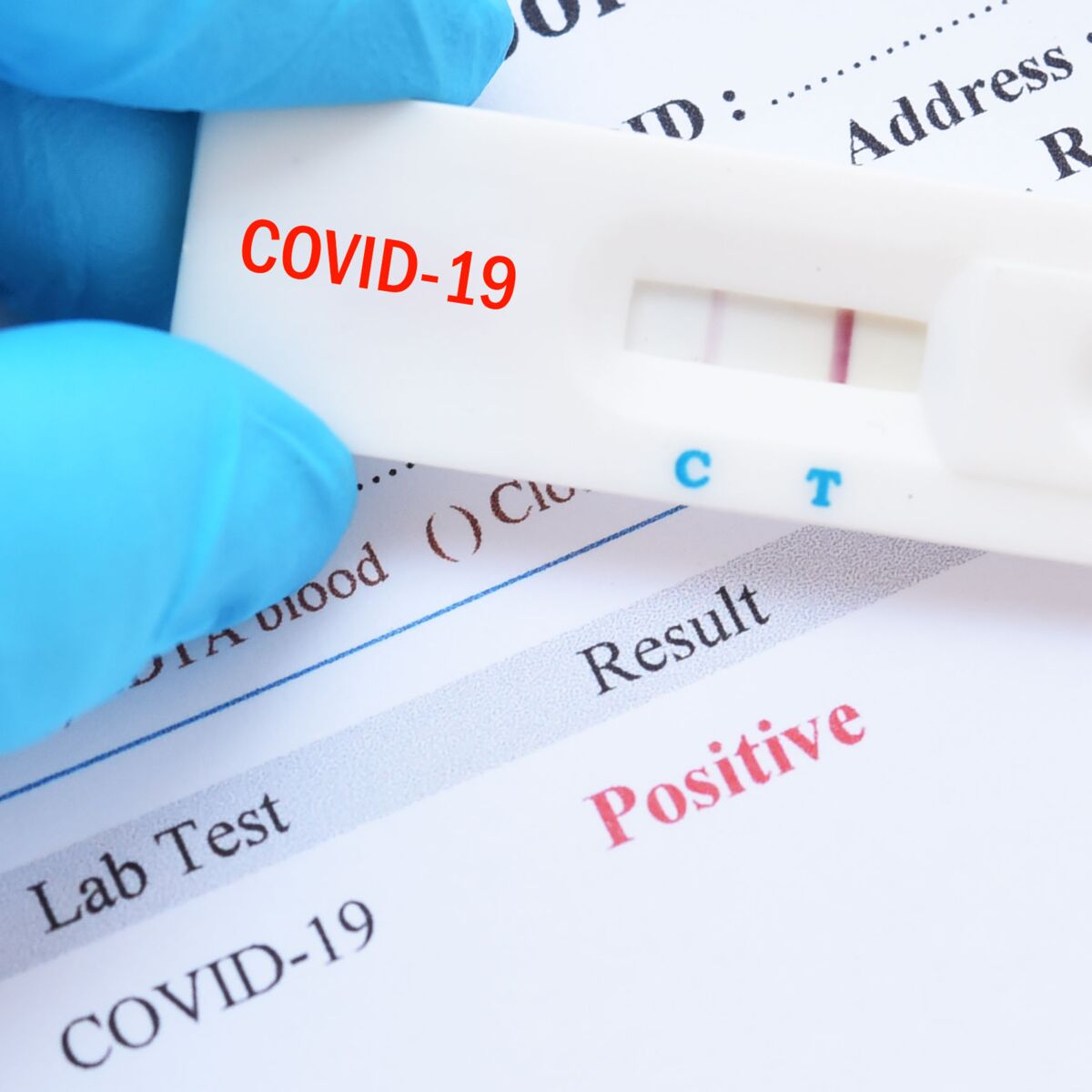 La grippe et la Covid 19 circulent actuellement à Mayotte