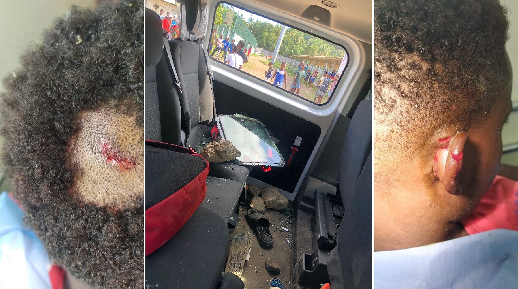 Le club de foot de Mamoudzou porte plainte après les caillassages