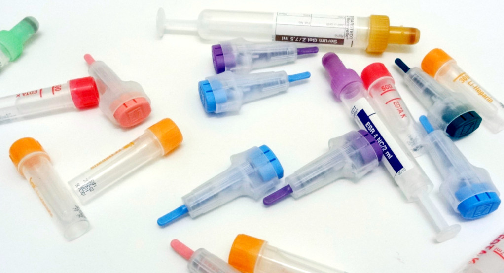 La sortie de crise au laboratoire, ce n’est pas pour tout de suite