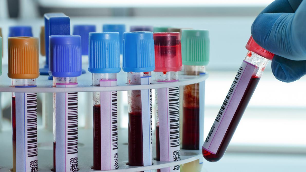 Vers une sortie de conflit au Laboratoire de Mayotte ?