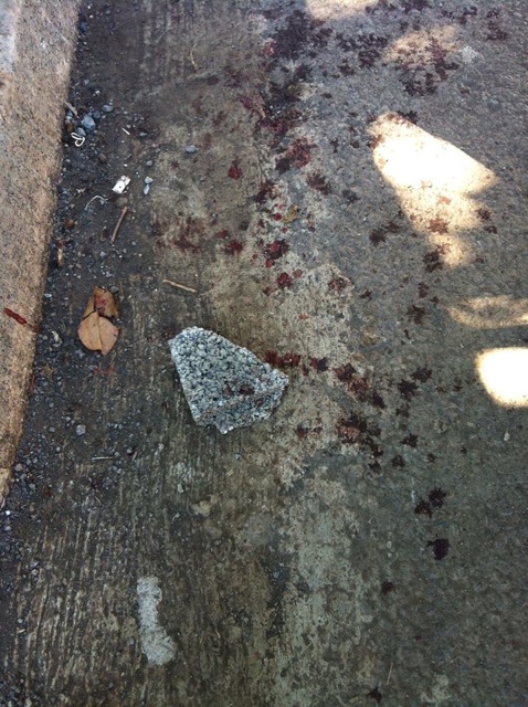 Les photos du policier de la PAF blessé à Majicavo