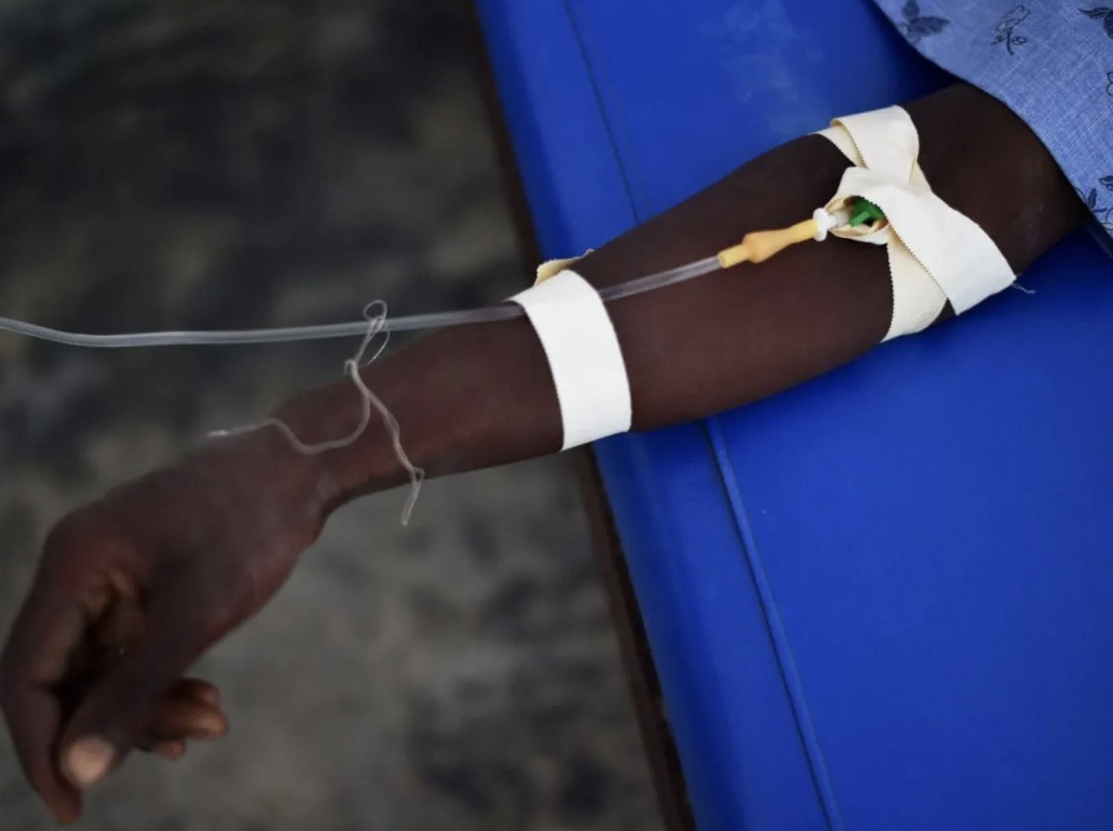 Le choléra est toujours une réalité à Mayotte