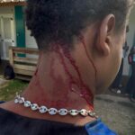 Agression d’un lycéen à proximité du Lycée de Chirongui