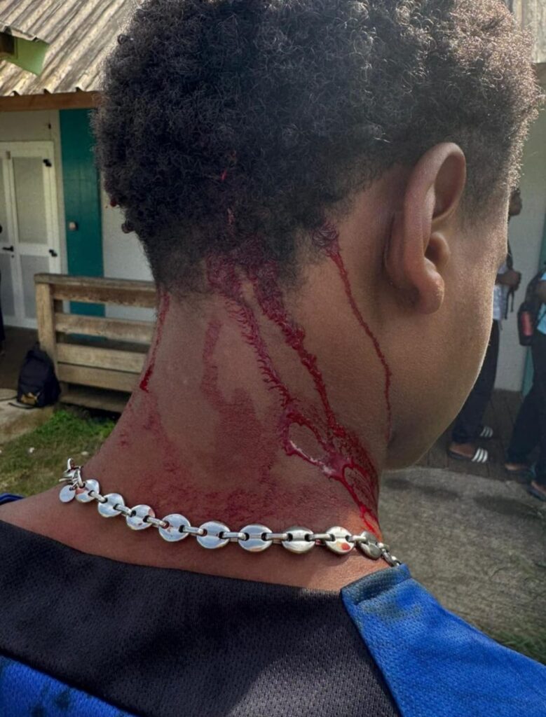 Agression d’un lycéen à proximité du Lycée de Chirongui 6 WhatsApp Image 2026 01 19 at 08.56.14